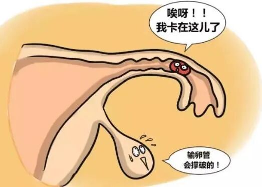 你只羡慕人家儿女双全，但却不知保胎背后的艰辛！