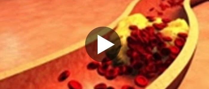 一旦身体出现血栓，这4个地方会“告诉你”，早发现早治疗