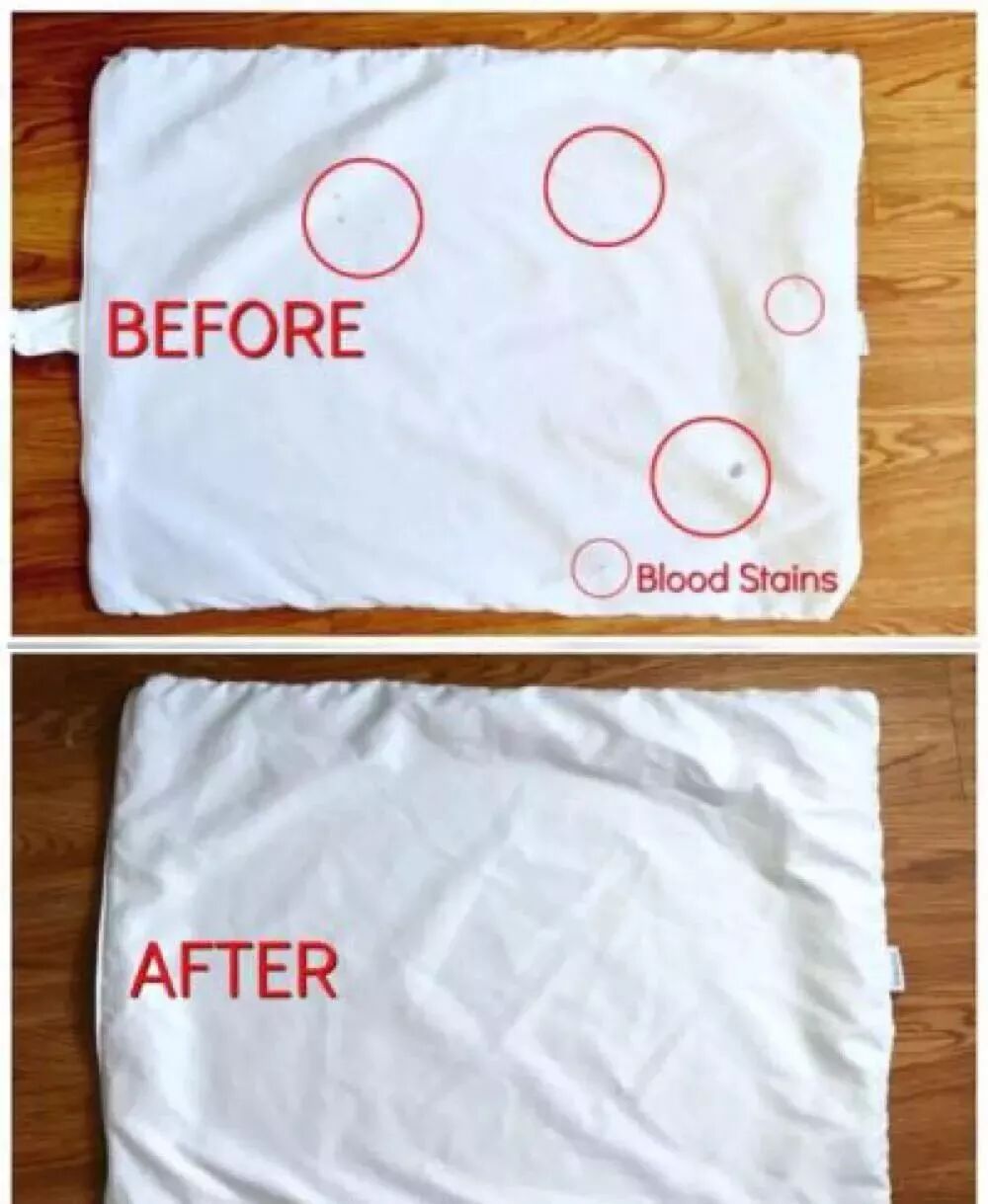 枕头用了半年就发黄,有了这小窍门,立马变. - 1977966507的主页