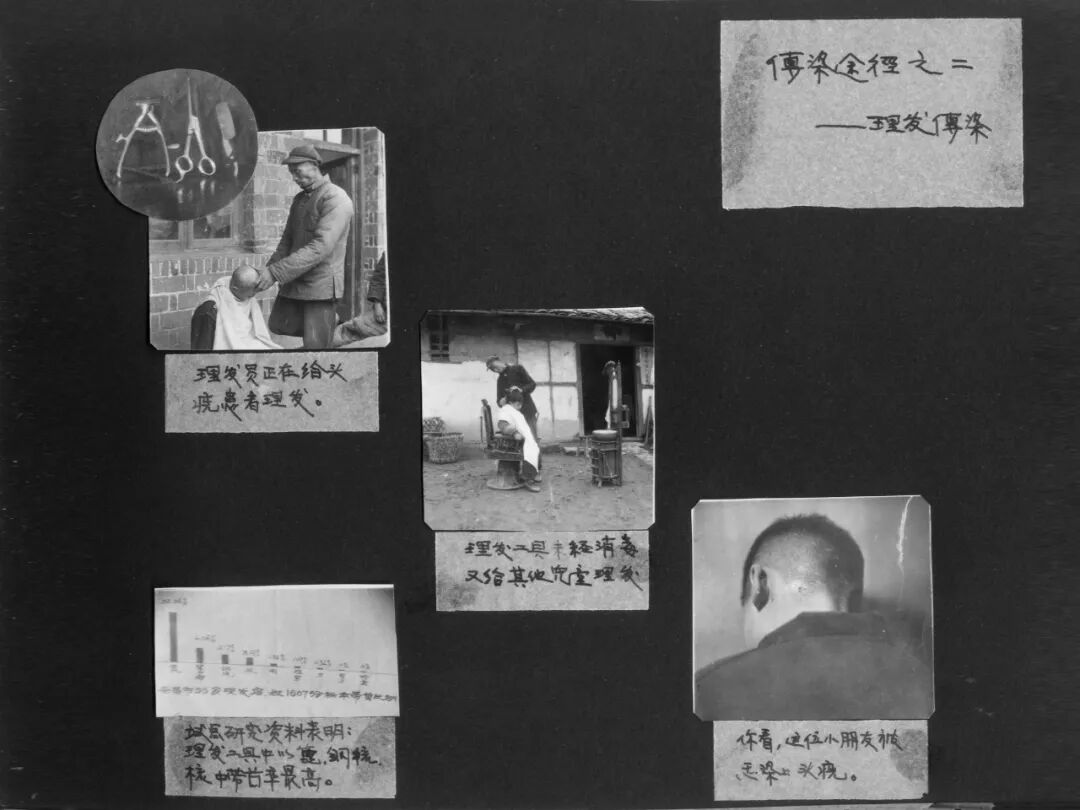 头癣的故事一文说清儿童头癣