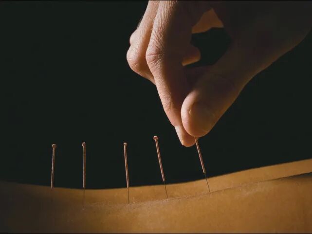 针灸治疗仪什么品牌好脊柱侧弯不用慌，“龙氏正骨”帮您忙~_https://www.jmylbn.com_新闻资讯_第15张