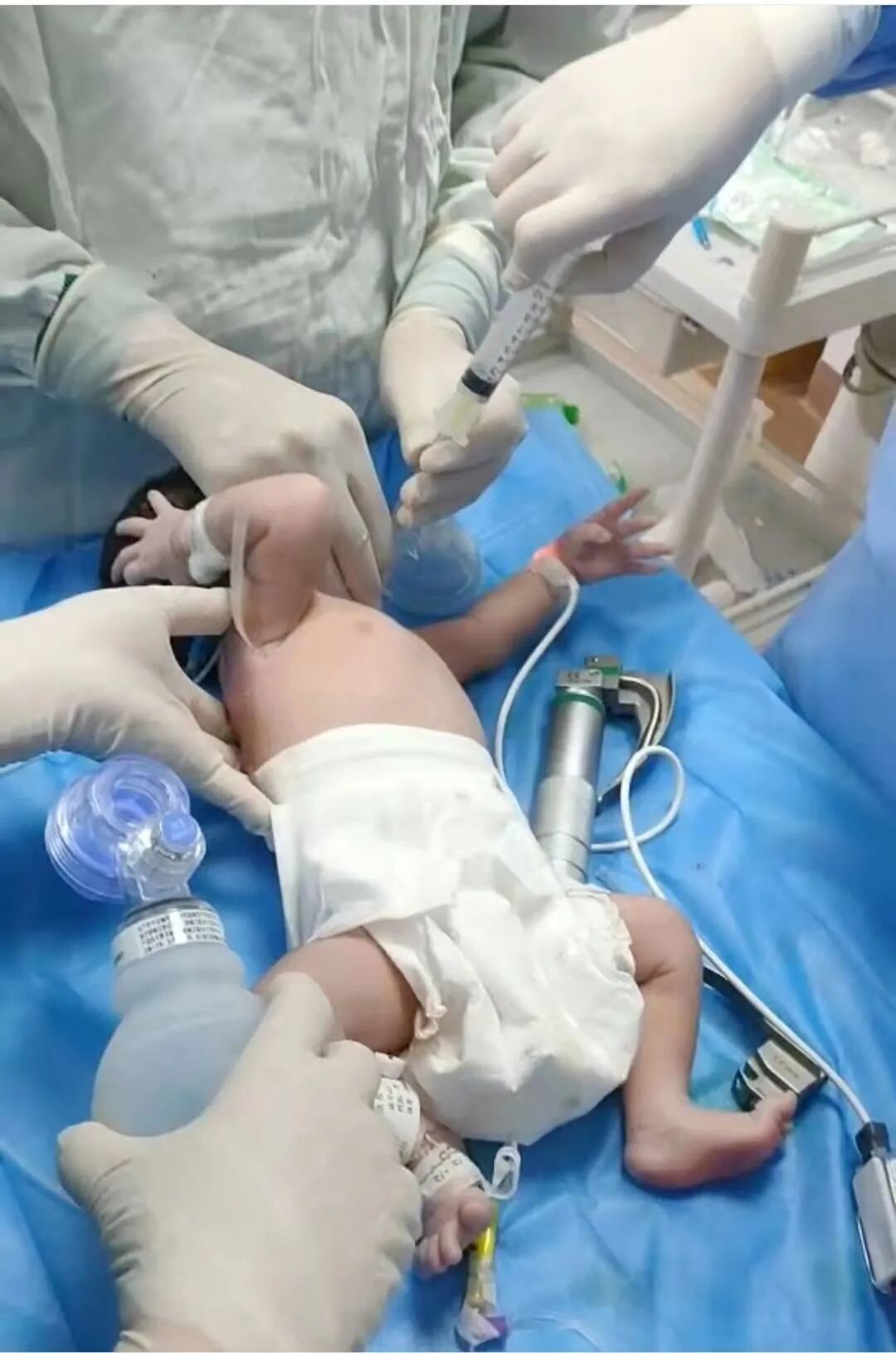 为什么新生儿抢救台和时间赛跑｜我院成功救治重症新生儿_https://www.jmylbn.com_新闻资讯_第3张