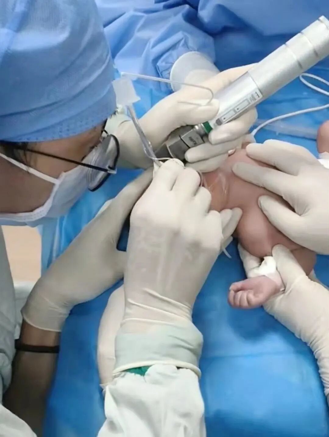 为什么新生儿抢救台和时间赛跑｜我院成功救治重症新生儿_https://www.jmylbn.com_新闻资讯_第5张