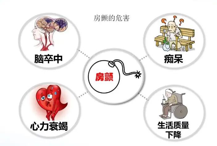 【专家谈科普】危险的"心动"感觉 房颤你了解多少?-安徽医科大学第一