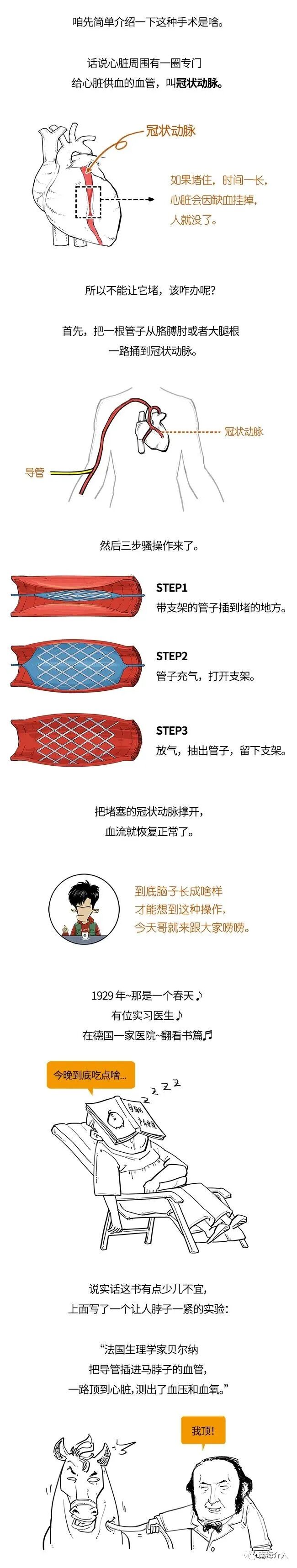 介入怎么进导管介入的鼻祖：小伙把导尿管插进自己心脏，插出个诺贝尔奖_https://www.jmylbn.com_新闻资讯_第4张