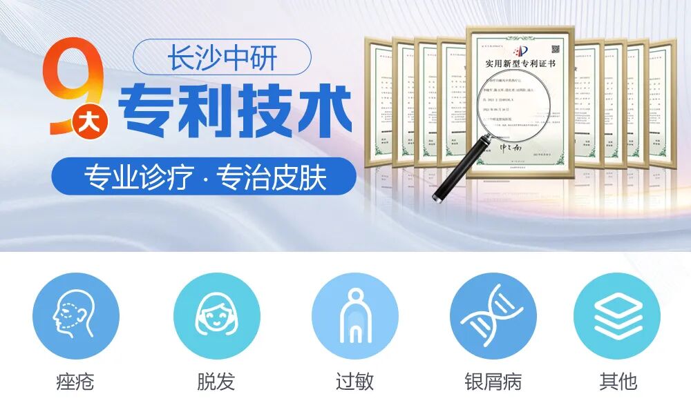 长沙皮肤科挂号丨手部脱皮是因为干燥？手癣、湿疹了解一下