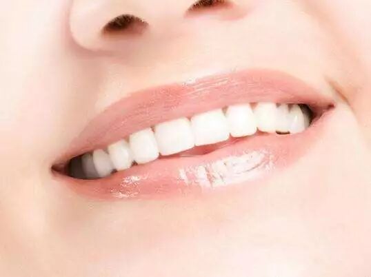 牙齿矫正前，你要想清楚这4件事