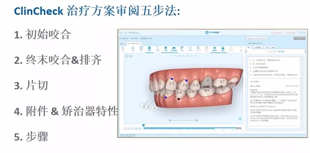 你会看隐适美方案吗 隐适美审阅方案五步法 隐适美e学堂 微信公众号文章阅读 Wemp