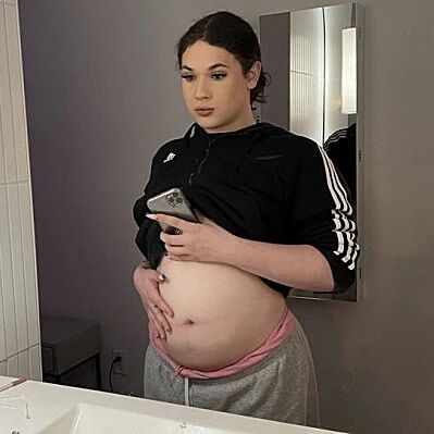 18岁男孩“雌雄同体”，有两套生殖器官，人工受孕成为一个男妈妈...