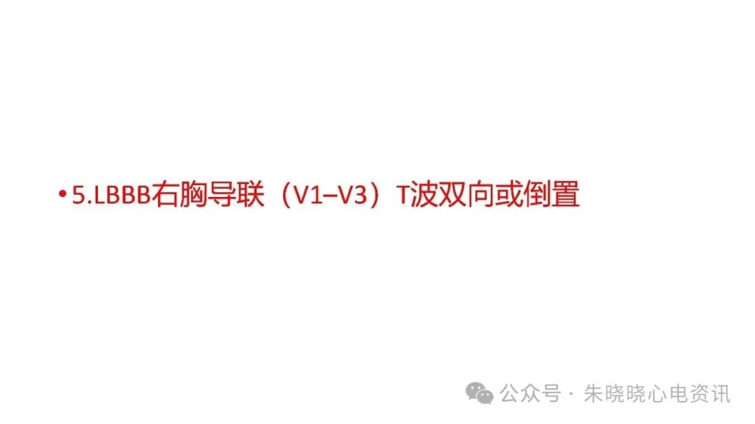 左束支阻滞再认识，实在太全了！