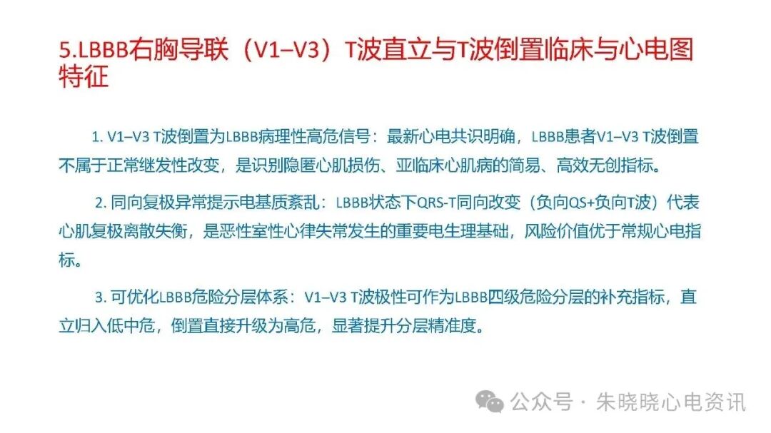 左束支阻滞再认识，实在太全了！