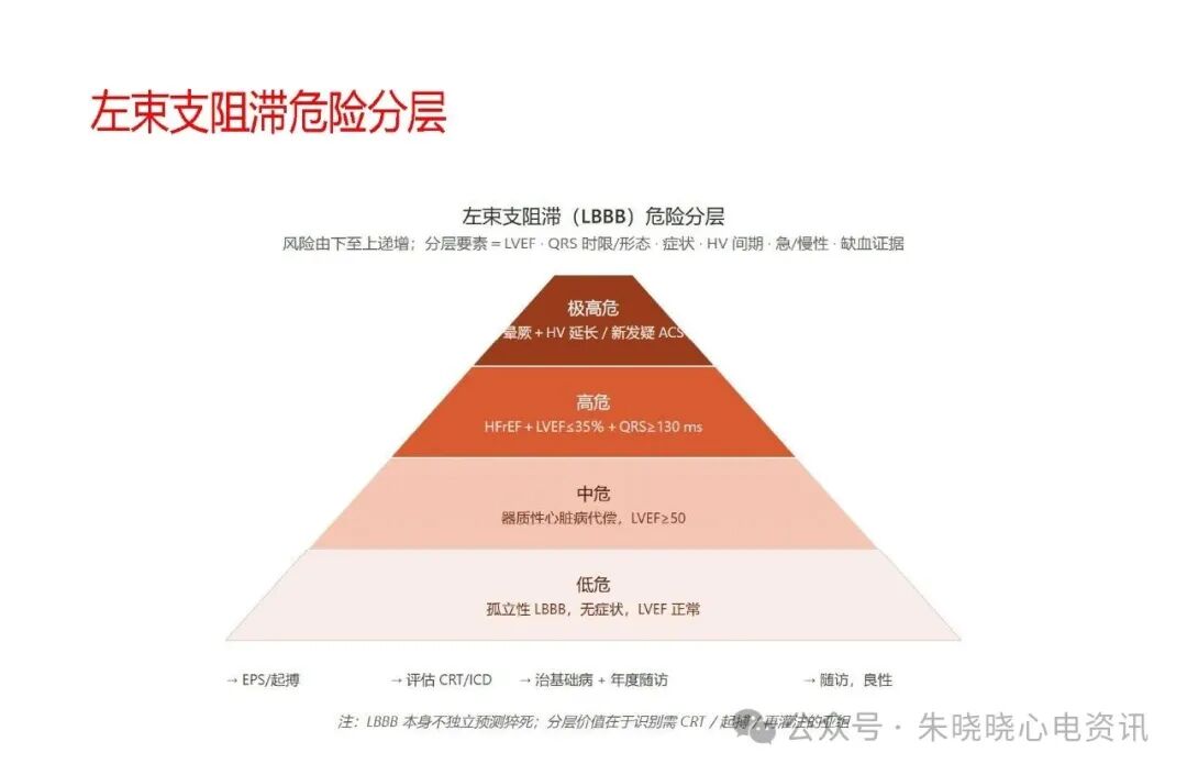 左束支阻滞再认识，实在太全了！