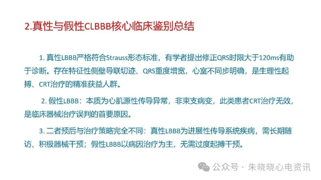左束支阻滞再认识，实在太全了！