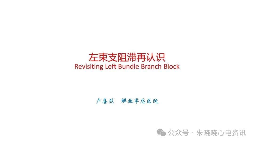 左束支阻滞再认识，实在太全了！