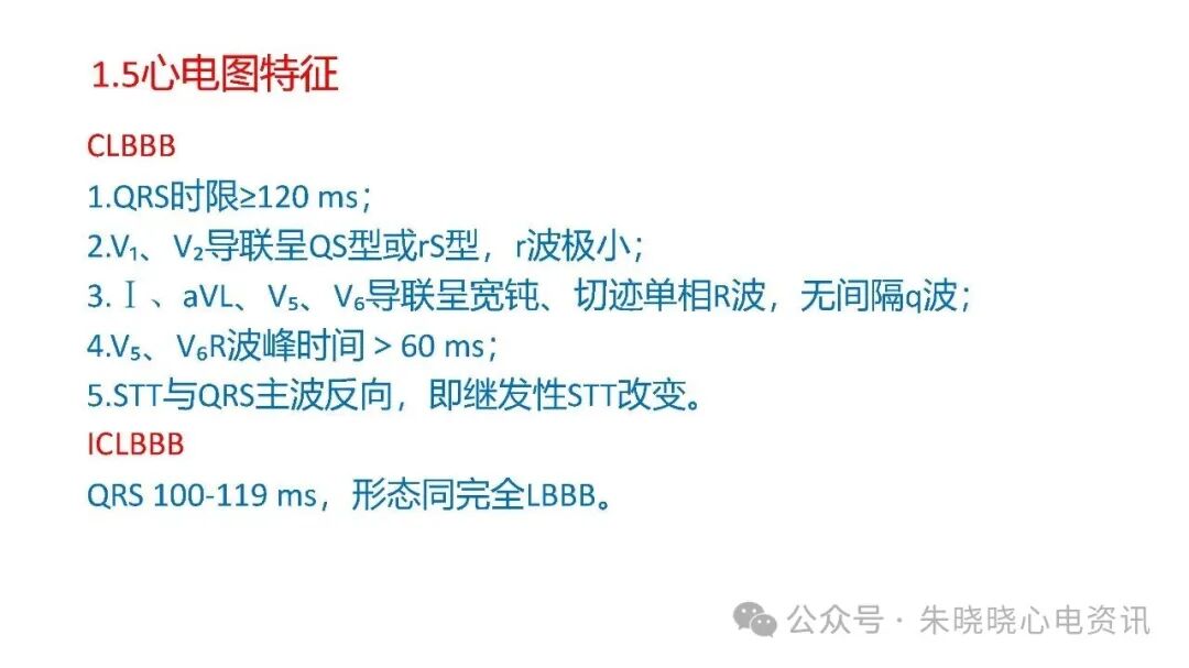 左束支阻滞再认识，实在太全了！