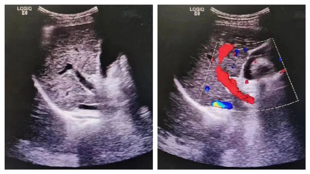 多普勒彩超图怎么看【妇幼科普】涨知识，明明做了“彩超”，为什么图像是黑白的？_https://www.jmylbn.com_新闻资讯_第6张