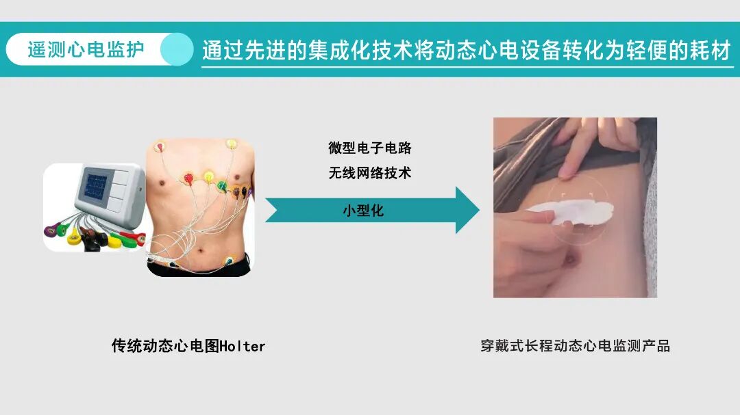 心电遥测怎么戴先进技术丨遥测心电监护，打造患者心脏哨兵_https://www.jmylbn.com_新闻资讯_第3张