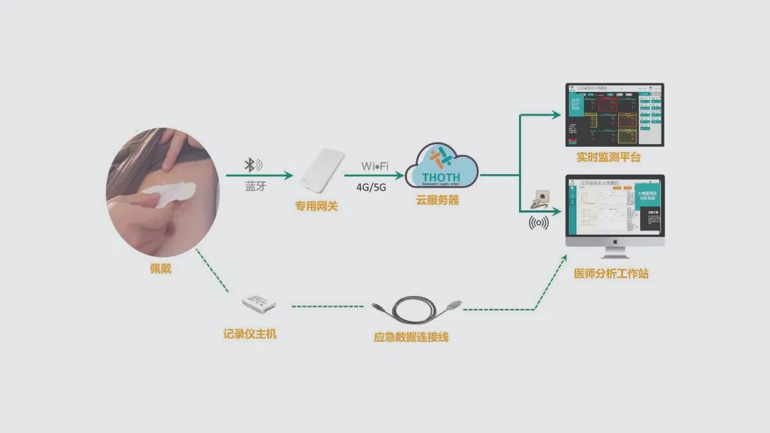 心电遥测怎么戴先进技术丨遥测心电监护，打造患者心脏哨兵_https://www.jmylbn.com_新闻资讯_第2张