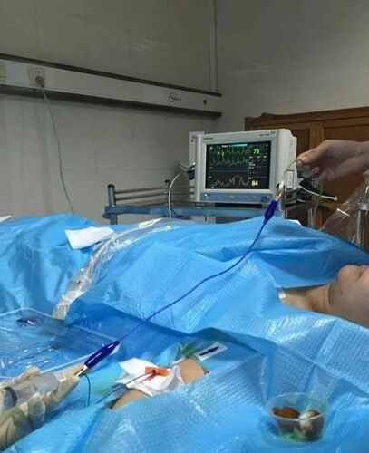 picc导管是什么材质带您走近PICC_https://www.jmylbn.com_新闻资讯_第4张