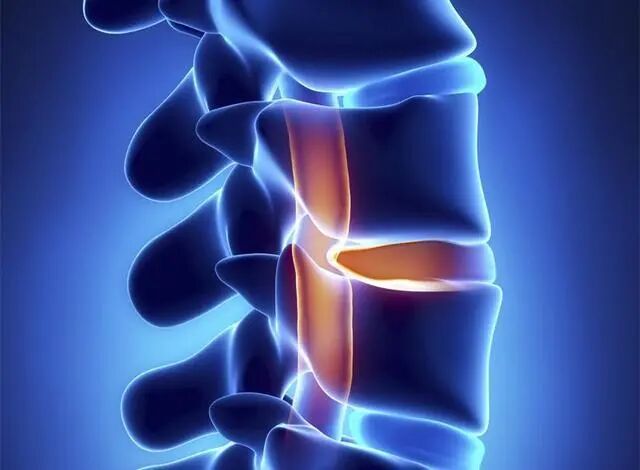 古法经络|为什么“我”的腰椎间盘会突出？
