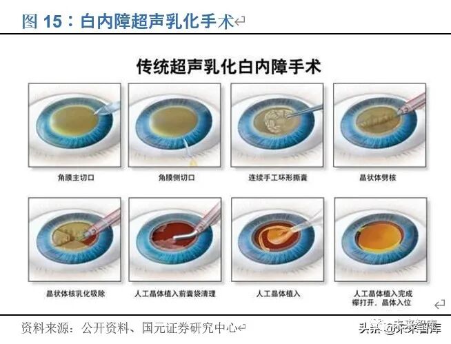 年眼科行业研究报告 行业研究报告 微信公众号文章阅读 Wemp
