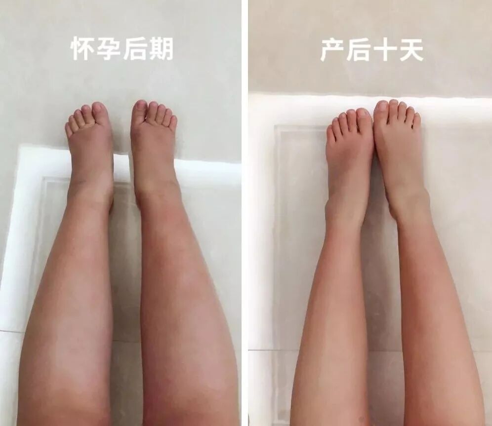 没做糖耐医院不给接生吗_医生没叫做糖耐_糖耐没做医院收产妇吗