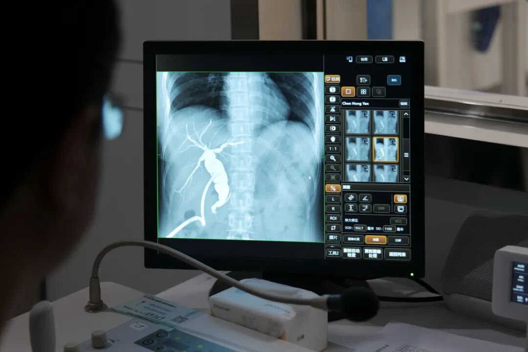 数字胃肠透视怎么做【三级医院创建 • 技术装备提升】数字胃肠检查，让胃肠疾病无处隐藏——我院引进多功能数字透视摄影系统_https://www.jmylbn.com_新闻资讯_第29张