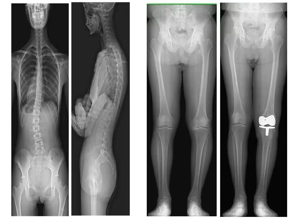 数字胃肠透视怎么做【三级医院创建 • 技术装备提升】数字胃肠检查，让胃肠疾病无处隐藏——我院引进多功能数字透视摄影系统_https://www.jmylbn.com_新闻资讯_第18张