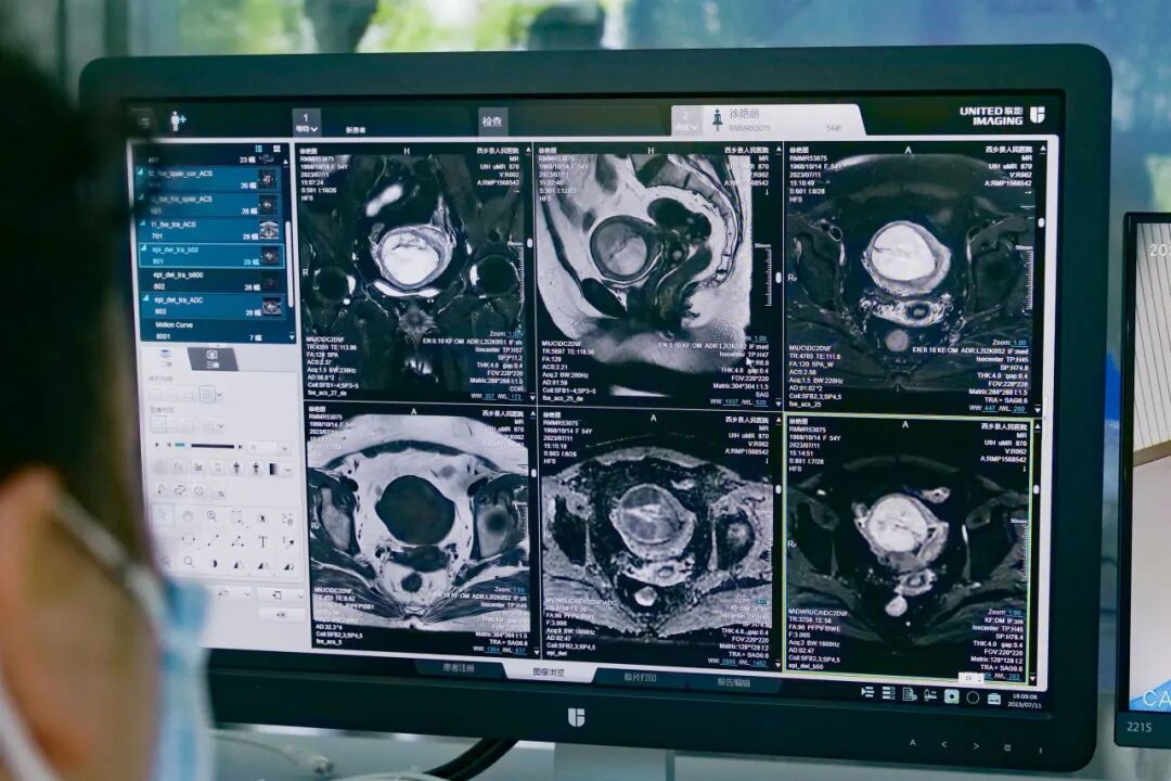 联影磁共振怎么样【三级医院创建 • 技术装备提升】再添医学影像“利器”——我院引进联影uMR870  3.0T磁共振_https://www.jmylbn.com_新闻资讯_第32张