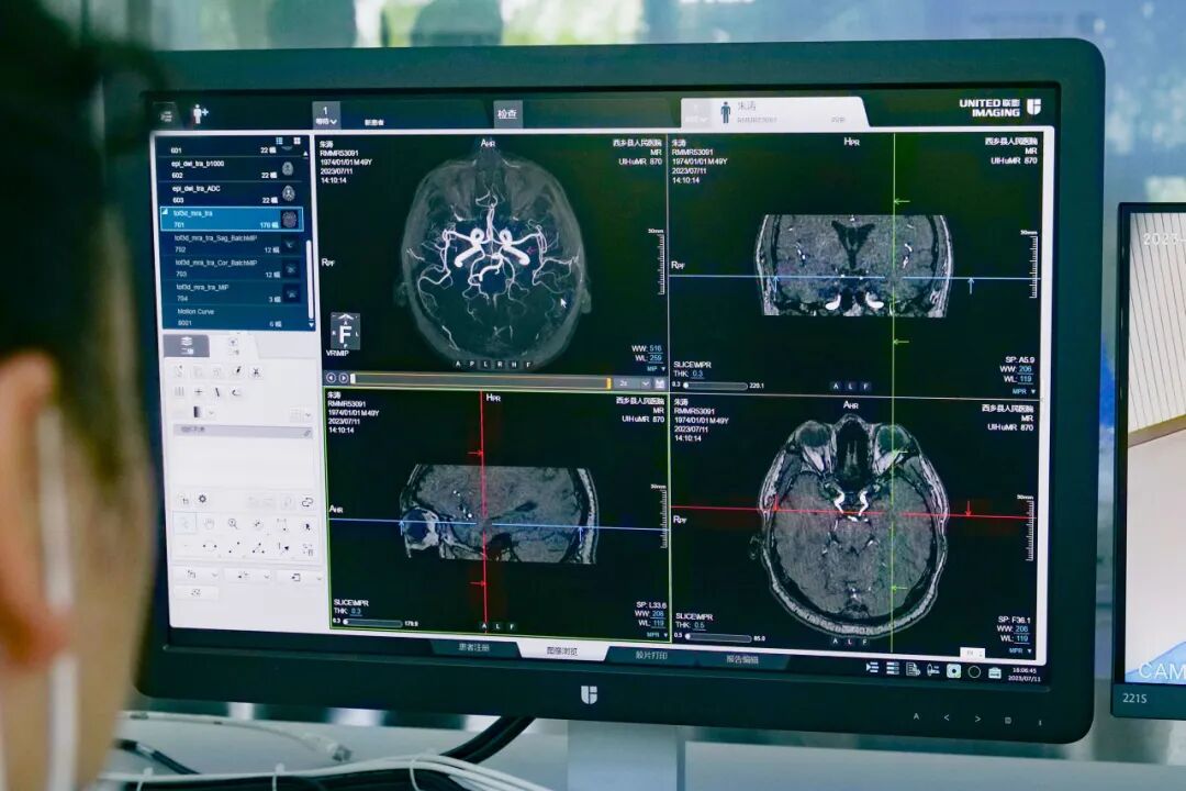 联影磁共振怎么样【三级医院创建 • 技术装备提升】再添医学影像“利器”——我院引进联影uMR870  3.0T磁共振_https://www.jmylbn.com_新闻资讯_第31张