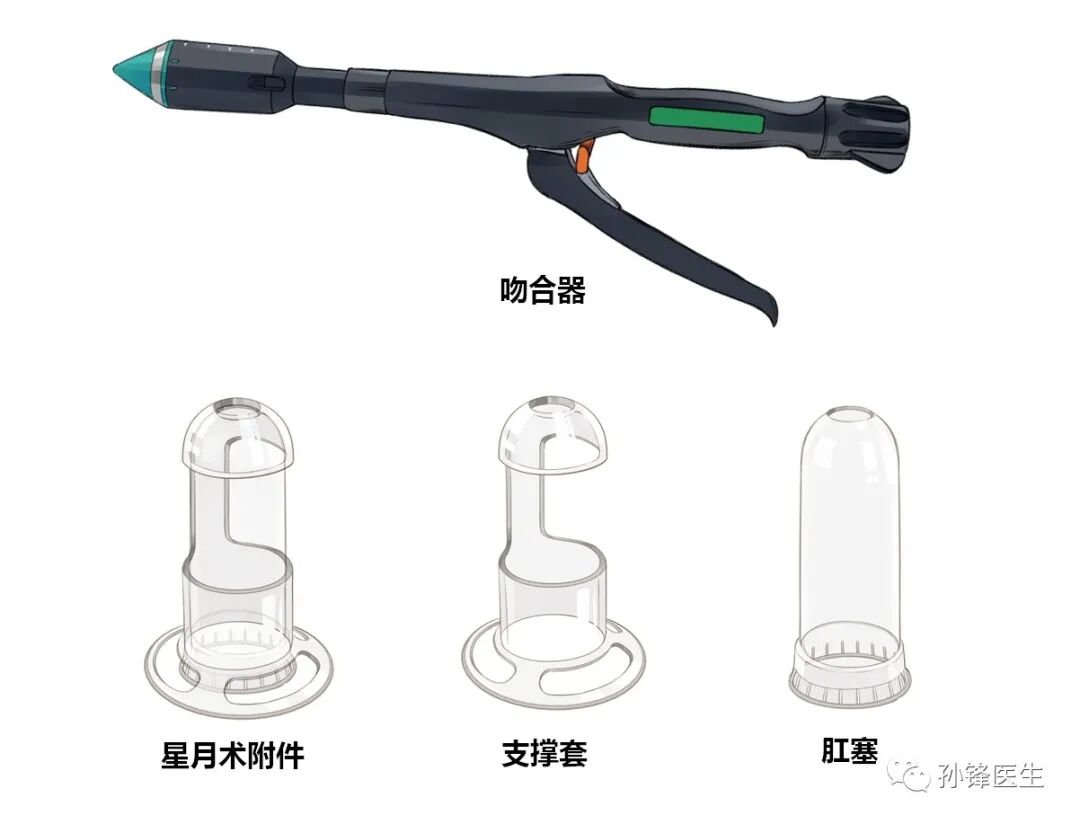 弧形吻合器怎么用痔的“星月术”：弧形直肠粘膜环切术+痔动脉结扎术_https://www.jmylbn.com_新闻资讯_第10张