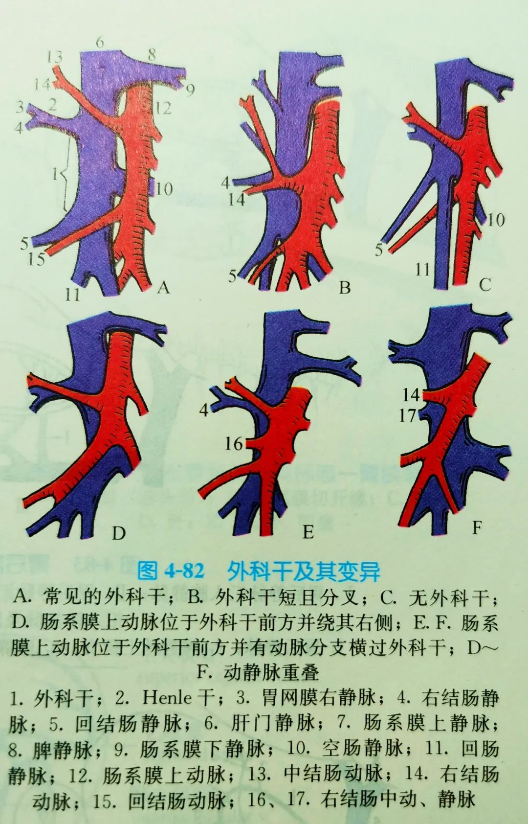 右半结肠手术的重要解剖标志:主要血管标志