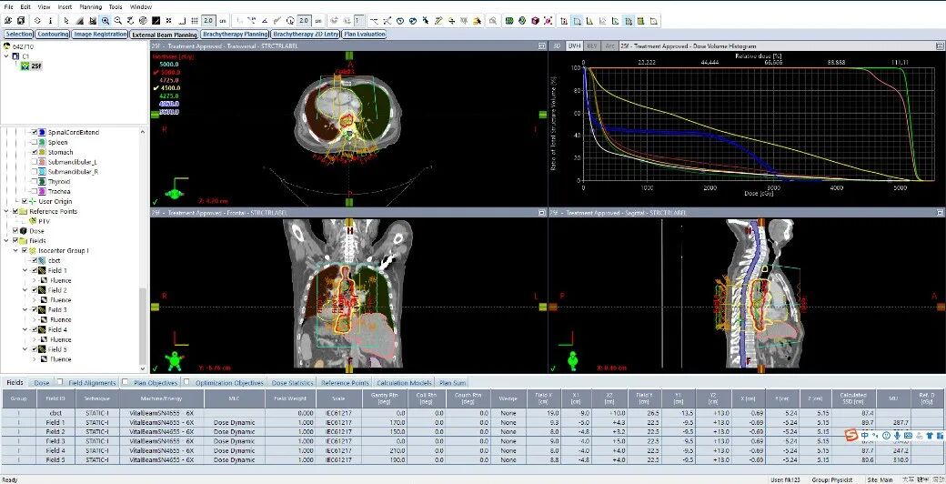 什么是定位放疗【放疗科普】模拟定位在放疗过程中究竟在模拟什么？_https://www.jmylbn.com_新闻资讯_第6张