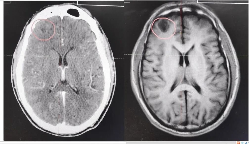 什么是定位放疗【放疗科普】模拟定位在放疗过程中究竟在模拟什么？_https://www.jmylbn.com_新闻资讯_第7张