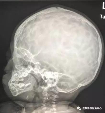 婴儿头部x光片图片