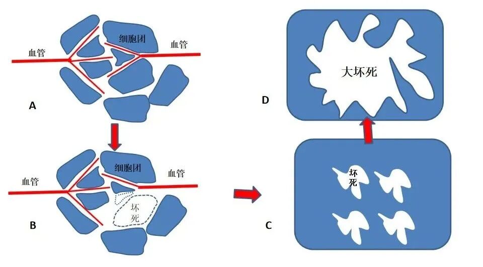 怎么买病理图文这些影像征象背后的病理基础，今天才知道！_https://www.jmylbn.com_新闻资讯_第10张