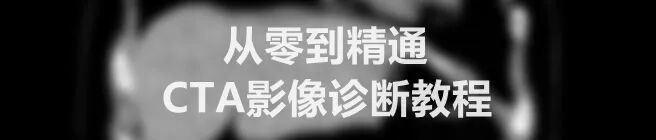床旁DR机怎么移动使用移动床边DR机拍胸片时，多远的距离才是安全的呢？_https://www.jmylbn.com_新闻资讯_第4张