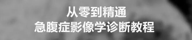 床旁DR机怎么移动使用移动床边DR机拍胸片时，多远的距离才是安全的呢？_https://www.jmylbn.com_新闻资讯_第7张