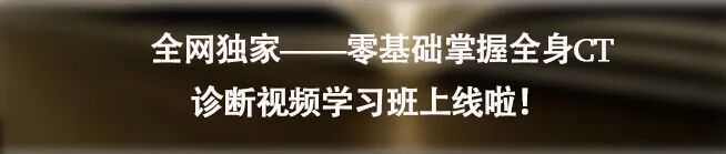 东软ct怎么样走出国门︱国产CT三剑客：联影、东软、安科的超高端CT新品_https://www.jmylbn.com_新闻资讯_第18张