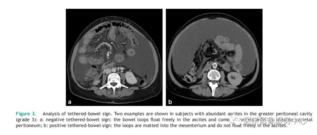 peritoneal cavity图片