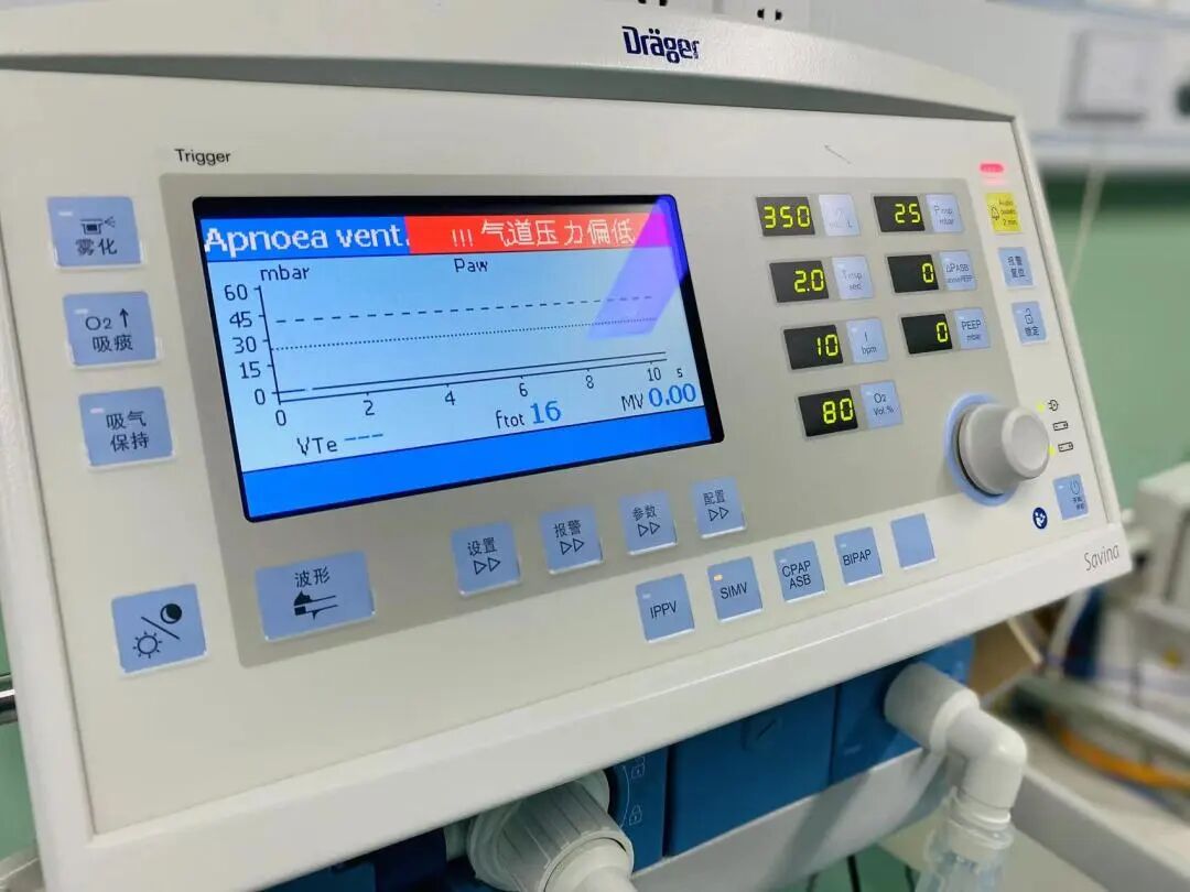 呼吸机是怎么用的呼吸机的常用模式和使用_https://www.jmylbn.com_新闻资讯_第2张