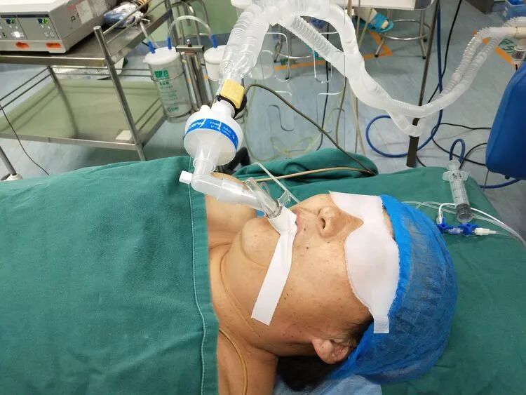 为什么要用喉罩你知道如何合理正确使用喉罩吗？_https://www.jmylbn.com_新闻资讯_第4张