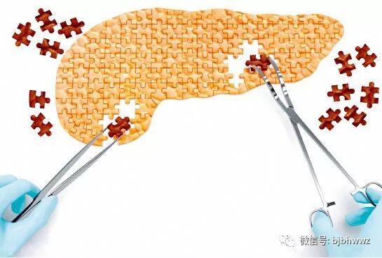 为什么胰腺癌如此难治？