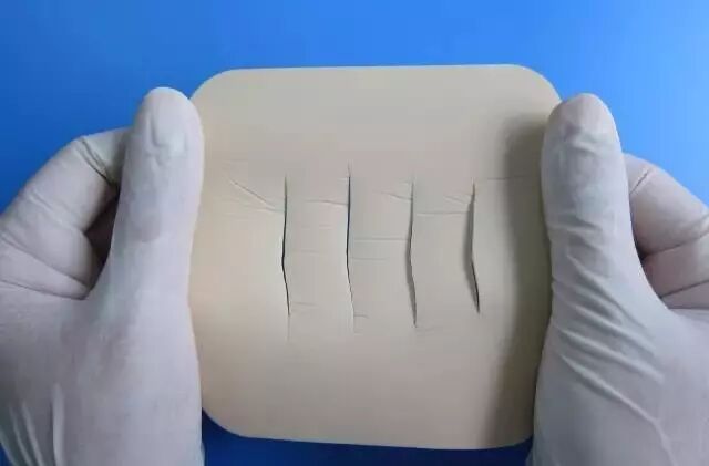 伤口贴敷料为什么特殊部位的敷料粘贴法，护士患者都该学学！_https://www.jmylbn.com_新闻资讯_第13张