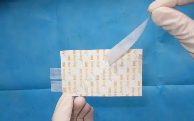 伤口贴敷料为什么特殊部位的敷料粘贴法，护士患者都该学学！_https://www.jmylbn.com_新闻资讯_第20张