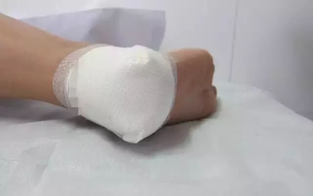 伤口贴敷料为什么特殊部位的敷料粘贴法，护士患者都该学学！_https://www.jmylbn.com_新闻资讯_第6张