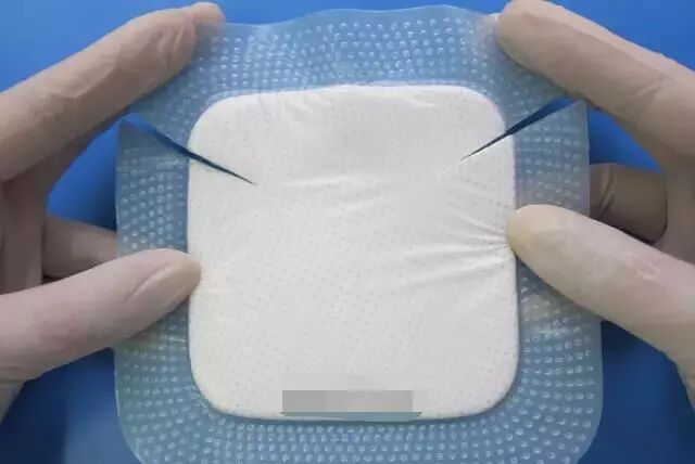 伤口贴敷料为什么​【伤口造口】各种敷料粘贴技巧_https://www.jmylbn.com_新闻资讯_第5张