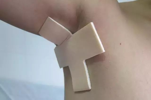 伤口贴敷料为什么会用有妙用！不同部位伤口，医用胶布怎么用？_https://www.jmylbn.com_新闻资讯_第4张