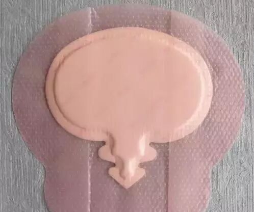 伤口贴敷料为什么特殊部位的敷料粘贴法，护士患者都该学学！_https://www.jmylbn.com_新闻资讯_第17张