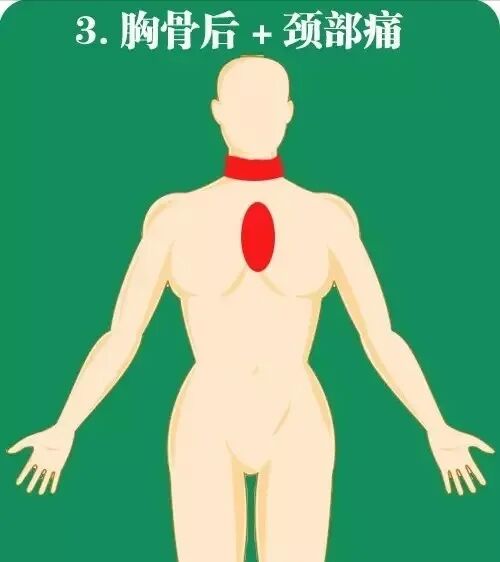 急性心肌梗死如何快速高效急救？